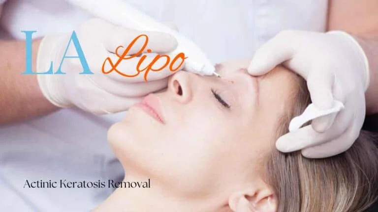 Woman receiving Actinic Keratosis Removal Treatment Farthingstone