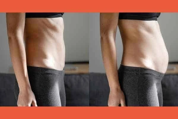 LA-EMS Body Sculpting results Farthingstone