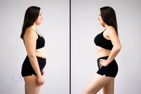 link between body image and mental health Farthingstone