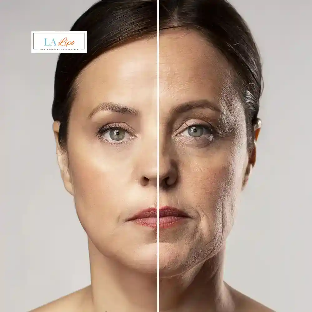 How Can You Tell If Non-Surgical Skin Tightening Is Right for You Farthingstone?