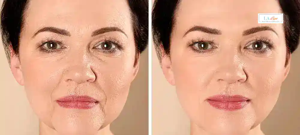 Why Aren’t My Skincare Products Making My Sagging Skin Look Firmer Farthingstone?