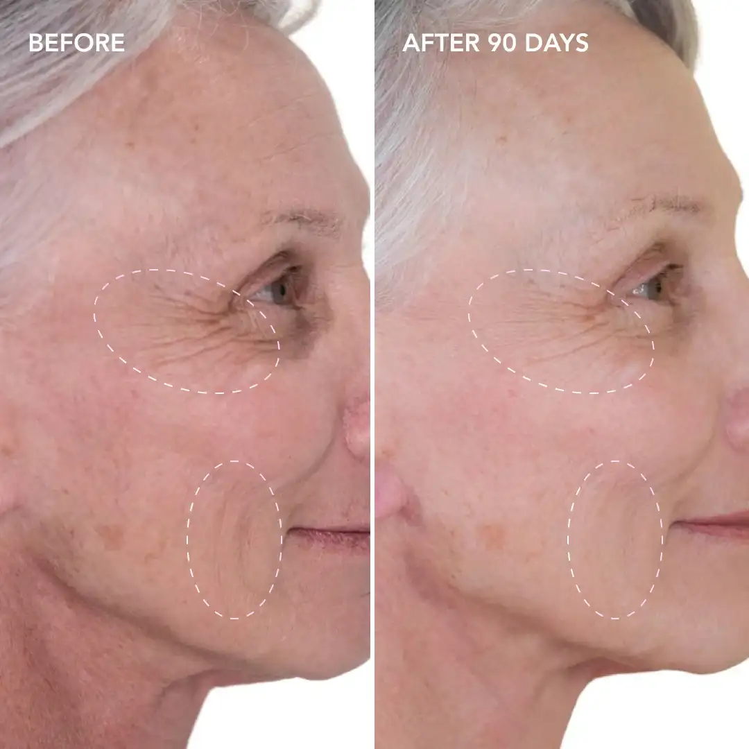 When will you see results Farthingstone
